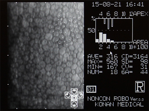 角膜上皮細胞の様子
